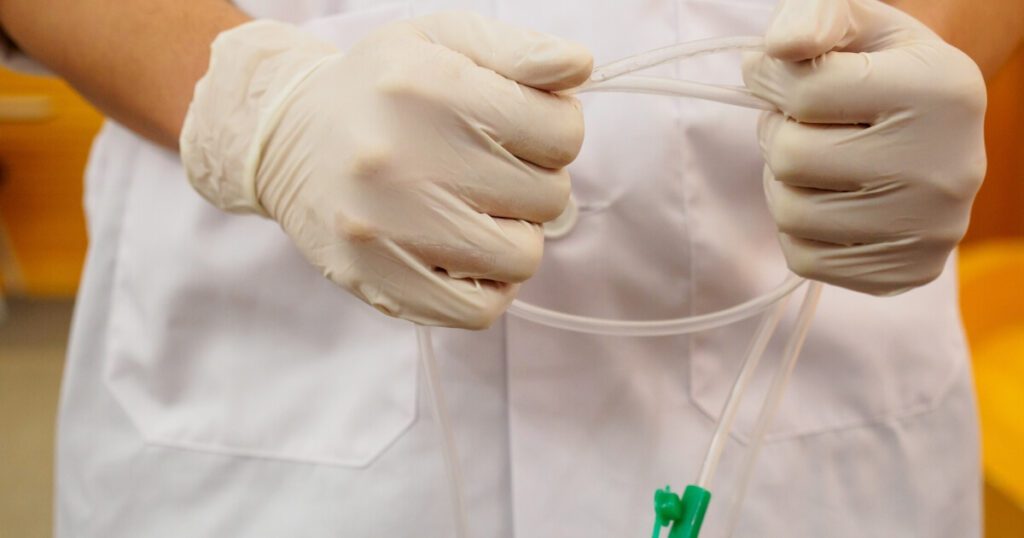 image of a nurse holding a feeding tube